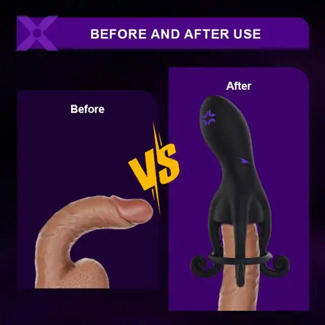 XG11 2 In 1 Male Vibrator & Cock Ring 10 Vibration Training Modes